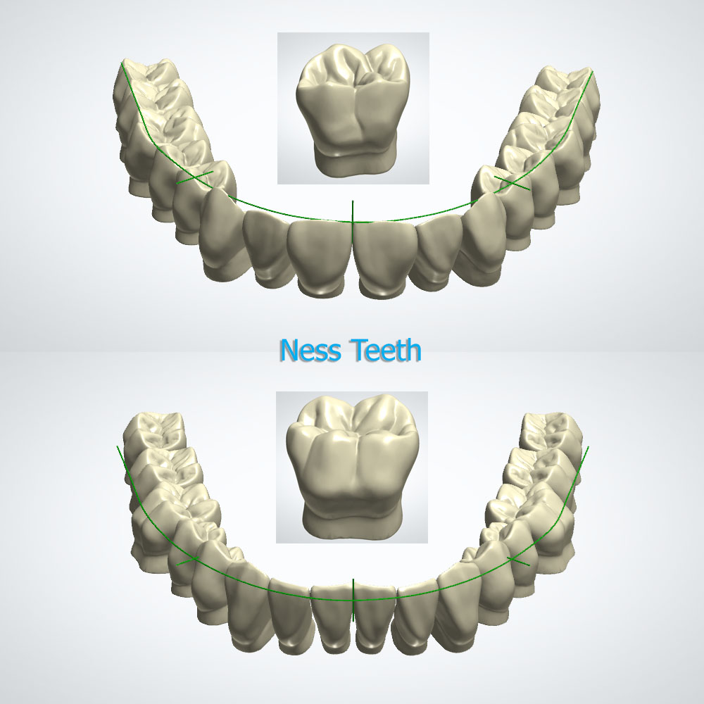 PTC Ness Teeth